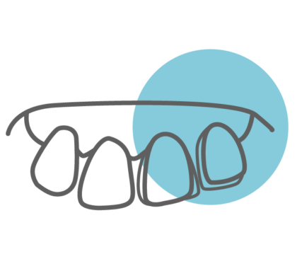 Composite Bonding
